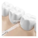 Irrigador Dental Boquillas Dobladas Gran Capacidad
